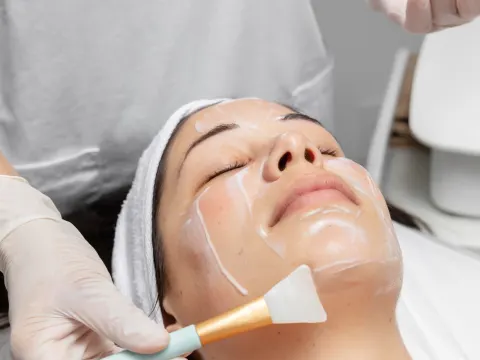 Aplicación de peeling químico con brocha en el rostro